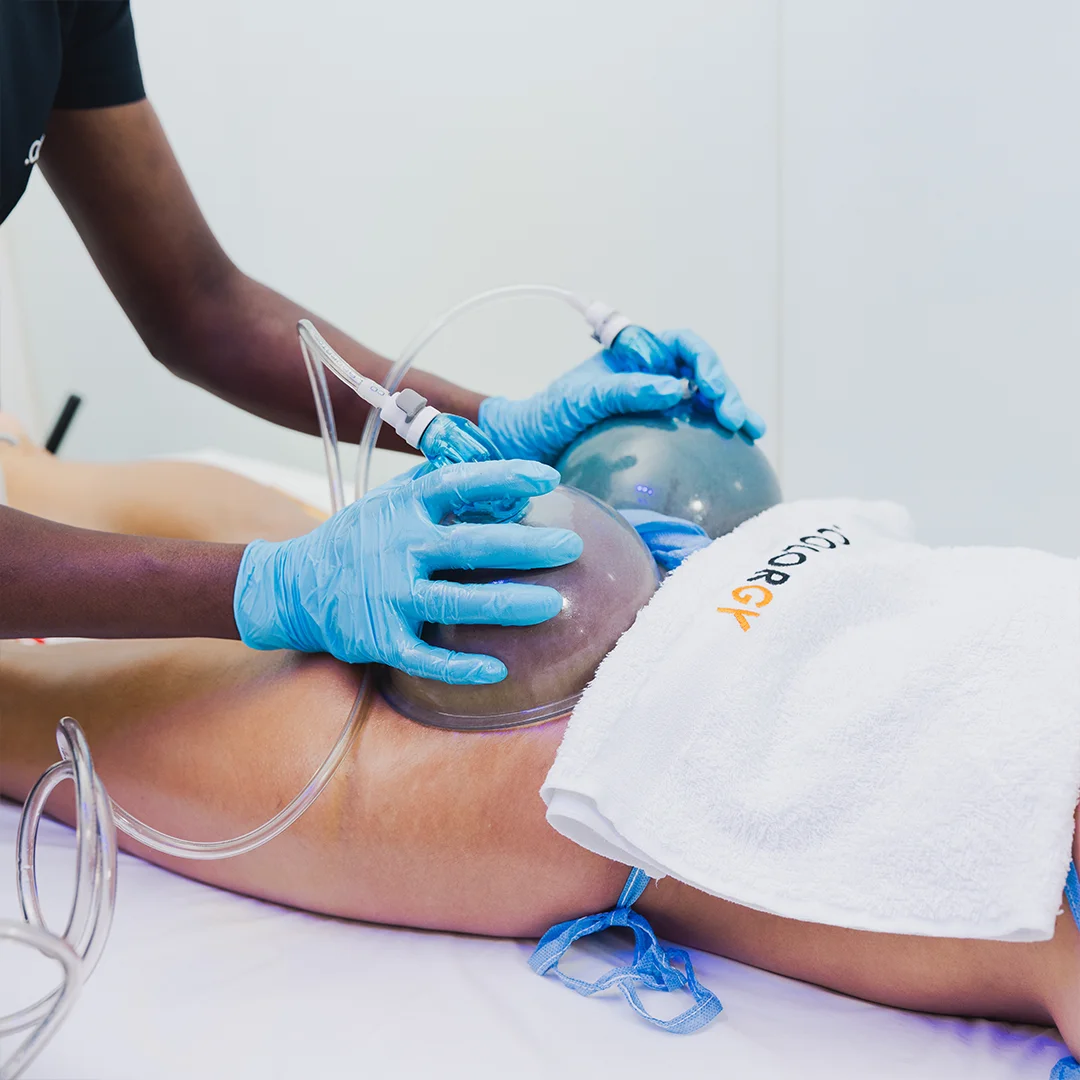 LEVANTAMIENTO DE GLÚTEOS / Un tratamiento hecho con las más avanzadas tecnologías incluyendo: lipolaser, cavitación, ultrasonido, presoterapia, corrientes rusas, radiofrecuencia y carboxiterapia.