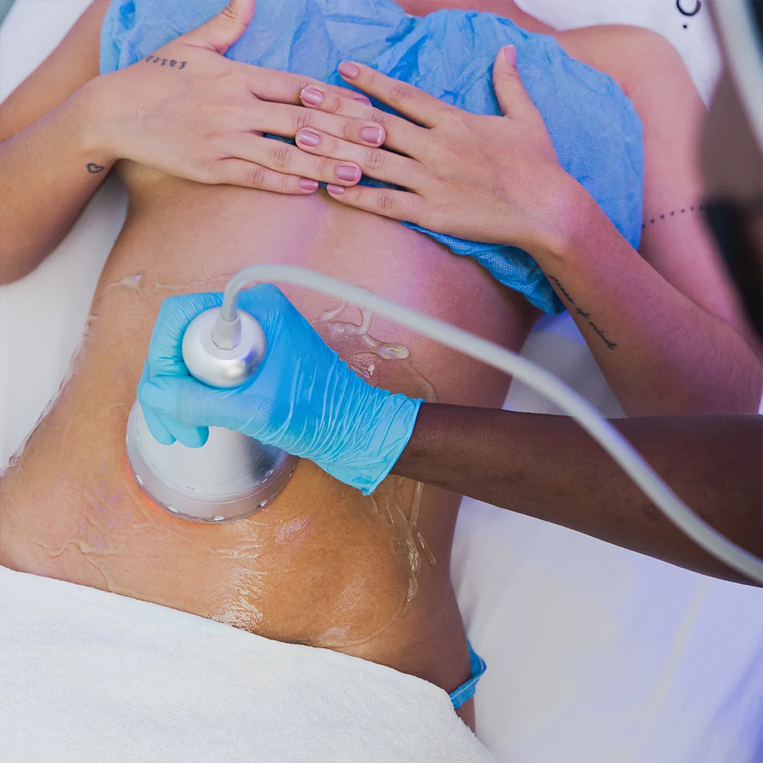 REDUCCIÓN Y TONIFICACIÓN DE ABDOMEN Y ESPALDA Un tratamiento